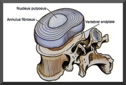 Intervertebral Disc